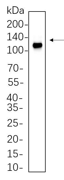 NLRP3 (R525V) Rabbit mAb